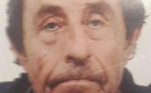 Zdjęcie przedstawia fragment twarzy 62-letniego mężczyzny od linii brwi do dolnej linii ust.