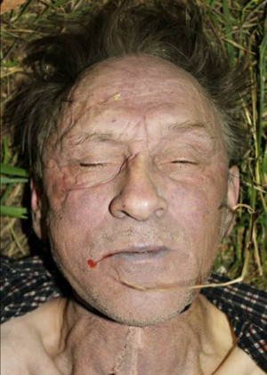 Zdjęcie przedstawia twarz zmarłego mężczyzny w wieku ok 50-60 lat.